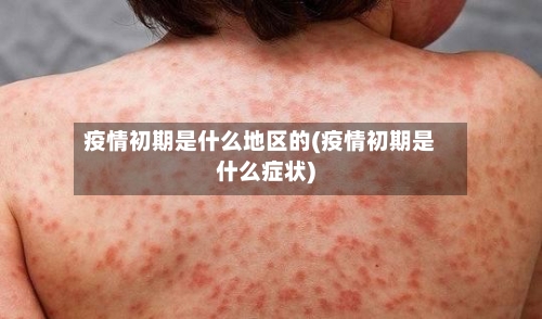 疫情初期是什么地区的(疫情初期是什么症状)-第2张图片