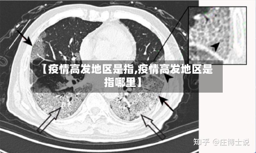 【疫情高发地区是指,疫情高发地区是指哪里】-第1张图片